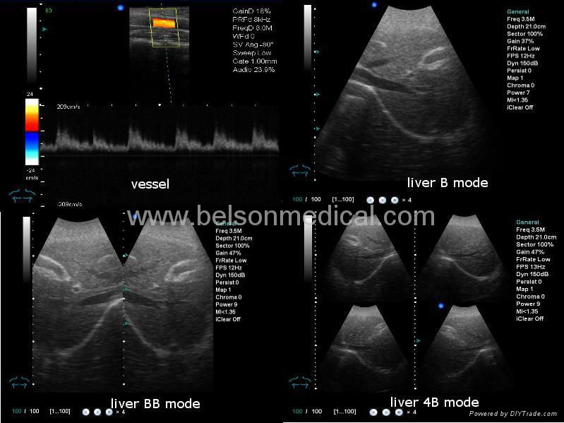 Color Doppler Ultrasound Scanner 5000M 4