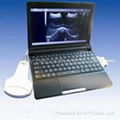 Digital Laptop Ultrasound Scanner 3000M 1