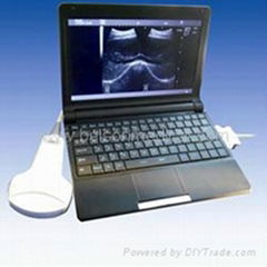 Digital Laptop Ultrasound Scanner 3000M