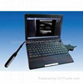 Veterinary Ultrasound Scanner 3000P