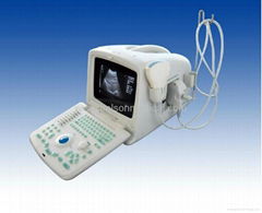 Portable Digital Ultrasound Scanner 200D