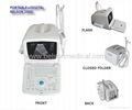 Portable Digital Ultrasound Scanner 200D 4