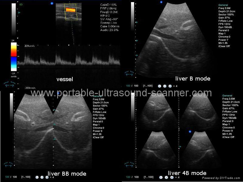 Economical Color Doppler 2