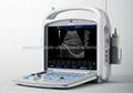 Full Digital Portable B/W Ultrasound