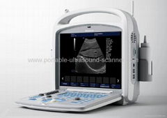 Full Digital Portable B/W Ultrasound