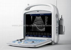 Full Digital Portable B/W Ultrasound Scanner