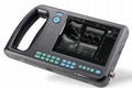 Palmtop Digital Ultrasound Scanner 1