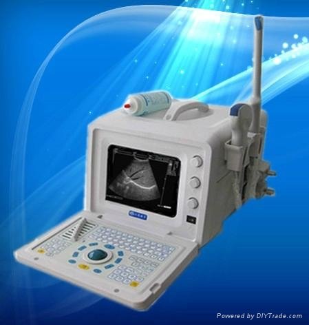  Portable B-type ultrasonic diagnostic apparatus
