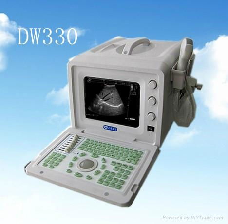 Full-digital Portable Ultrasound Scanner  2