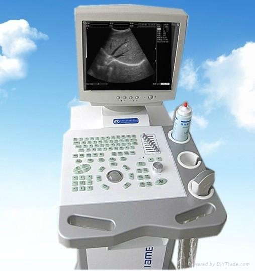 B Ultrasound Scanner Full Digital Trolley  2