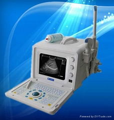 Portable B-type ultrasonic diagnostic apparatus