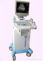  Digital Trolley Ultrasound Scanner 1