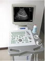 B Ultrasound Scanner Full Digital Trolley 1