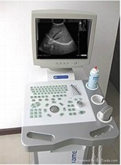 B Ultrasound Scanner Full Digital