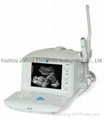 portable Ultrasound Scanner Ultrasound