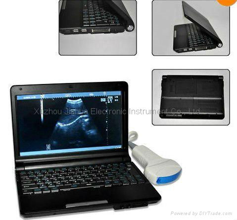 notebook/laptop ultrasound scanner Ultrasound Diagnostic system
