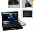 notebook/laptop ultrasound scanner