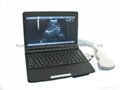 notebook/laptop ultrasound scanner Ultrasound Diagnostic system 2