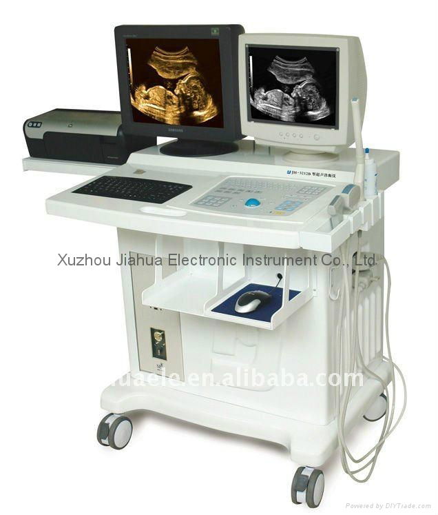 Deluxe Ultrasound Scanner Ultrasound Diagnostic Equipment