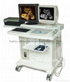 Deluxe Ultrasound Scanner Ultrasound Diagnostic Equipment 1