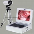 Laptop Digital Video Electronic Colposcope ( OEM )