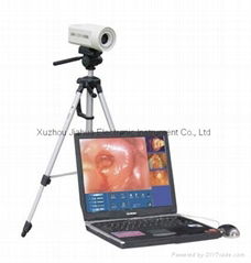 Laptop Digital Video Electronic Colposcope OEM