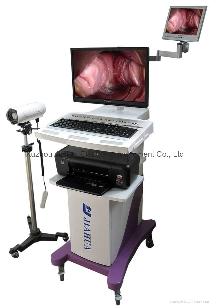 Digital Electronic Video Colposcope OEM Trolley