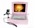 Laptop Infrared mammary diagnostic