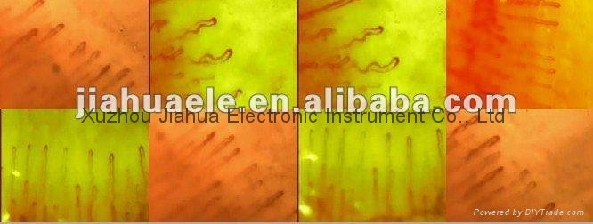 Microcirculation Microscope { Blood testing equipments } 2