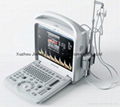 C21 Portable Color Doppler Ultrasound