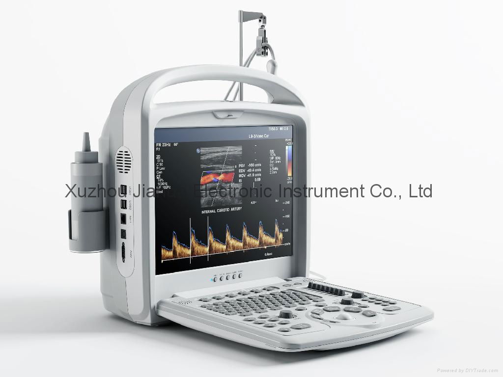 C21 Portable Color Doppler Ultrasound Scanner 2