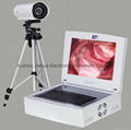 Laptop Digital Video Electronic Colposcope OEM 2