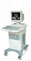 Deluxe Ultrasound Scanner Ultrasound Diagnostic Equipment 2