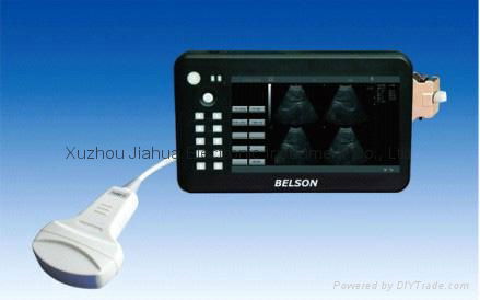 Hand Hold / palm ultrasound scanner ( OEM ) 2