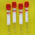 Medical vacuum blood collection tube 3