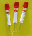 Medical vacuum blood collection tube 5