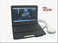 LEO-3000D1 Digital Ultrasound Equipment