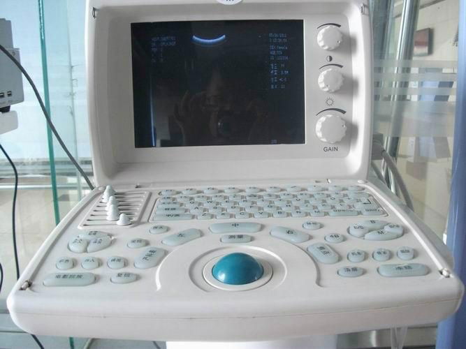 LEO-3000D1  ultrasound scanner