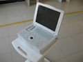 LEO-3000E1 Laptop Digital Ultrasound