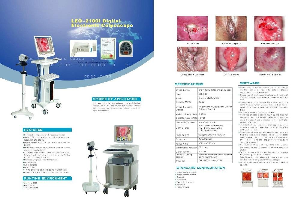 Electronic Colposcope with CE mark 2