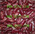 Purple Speckled  Kidney Beans 1