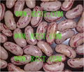 Light Speckled Kidney Beans 1