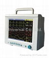 Patient Monitor (Multiparameters) 4