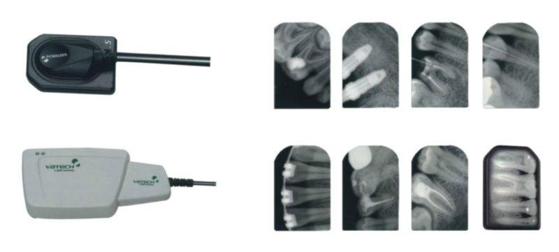 portable dental x ray unit 3