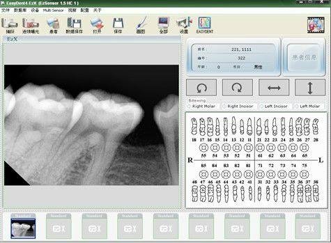 portable dental x ray unit 4
