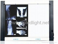 LED x ray film viwer box