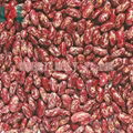 British red kidney bean 3