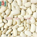 white kidney bean 1