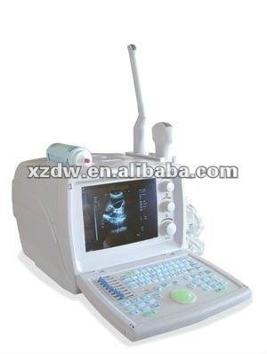 Full -Digital ultrasonic diagnostic apparatus