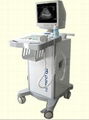 B Ultrasound Scanner Full Digital Trolley 1